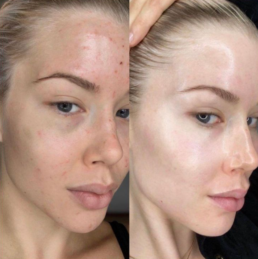Mascarilla Envolvente de Colágeno - Cuidado  Nocturno Intensivo