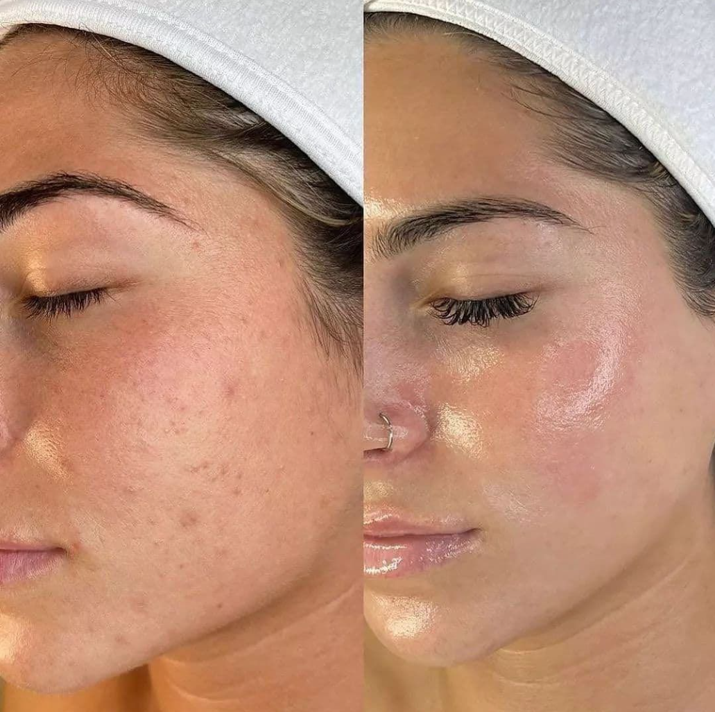 Mascarilla Envolvente de Colágeno - Cuidado  Nocturno Intensivo